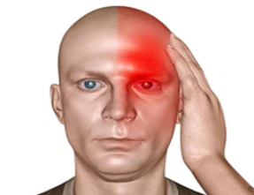 Paroksismal Hemikrania